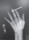 Not Rob's co-worker's hand – an x-ray of an anonymous dude’s hand from the National Medical Library.