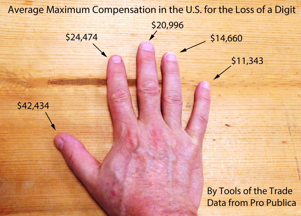 compensation by workers comp for the loss of digits